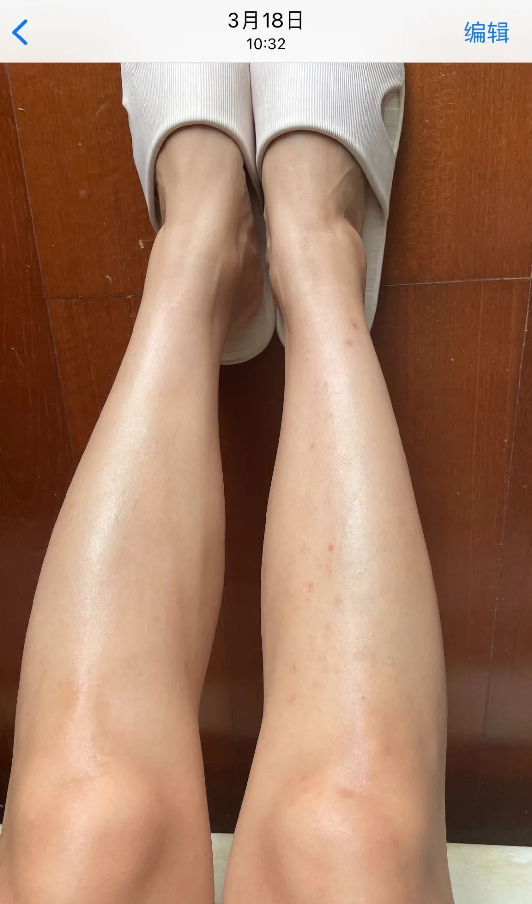 真实有效黑皮美白,针对天生黄黑皮美白一个月