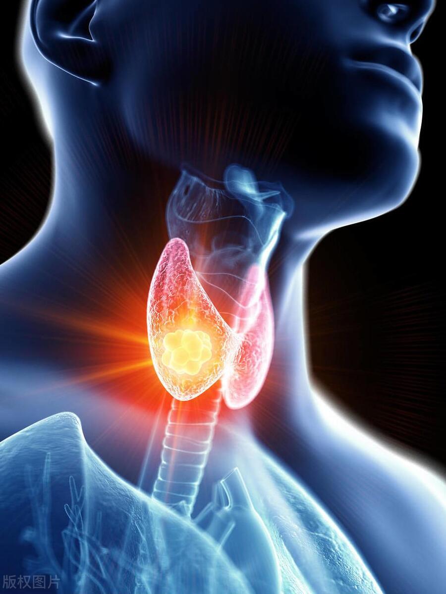 喝酒三十年喝出河马脖,辽宁大叔喝酒40年喝成河马脖子