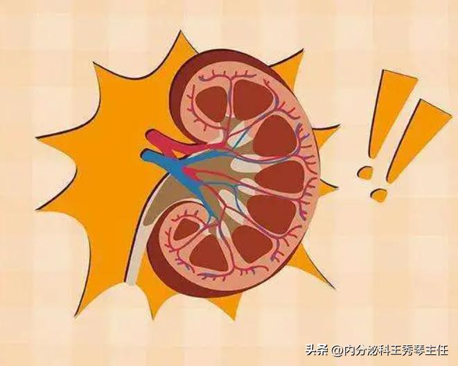 急性肾盂肾炎能治断根吗,急性肾炎吃什么药好得快