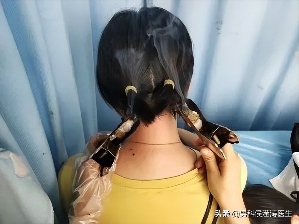 冬病夏治三伏天要注意什么,三伏是冬病夏治的最好时机