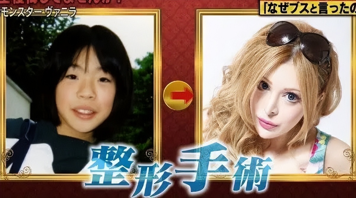 日本网红砸3亿整容上百次！整成法国娃娃：丑八怪在日本活不下去