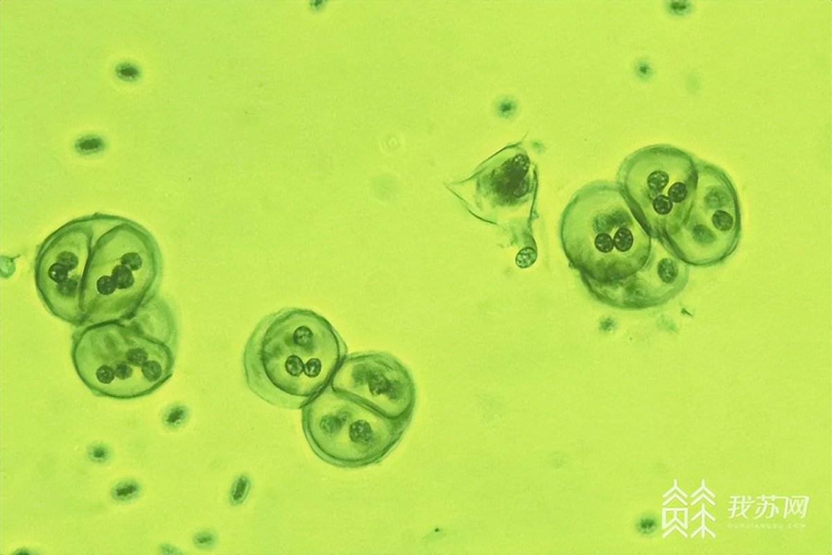 「十年弄潮江海声·夺冠」蓝藻治理的定湖神器
