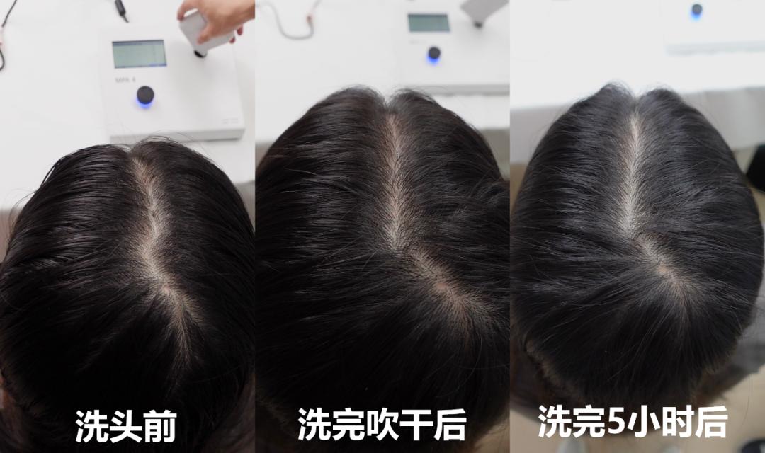 洗发水推荐控油蓬松去屑真实测评,洗发水测评真实推荐控油蓬松去屑