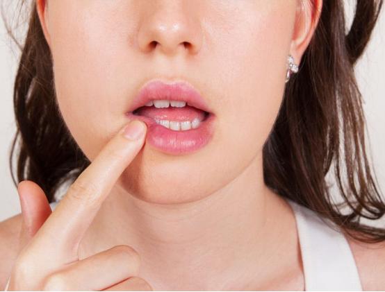 嘴上出了好多透明水泡会传染吗,嘴上上火长水泡会传染吗