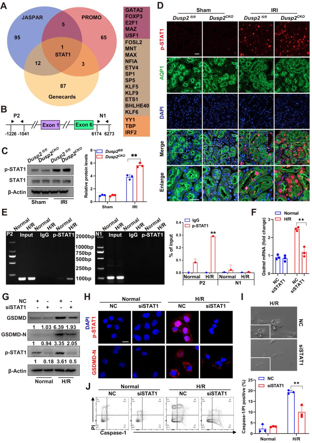 Theranostics|急性肾损伤治疗策略
