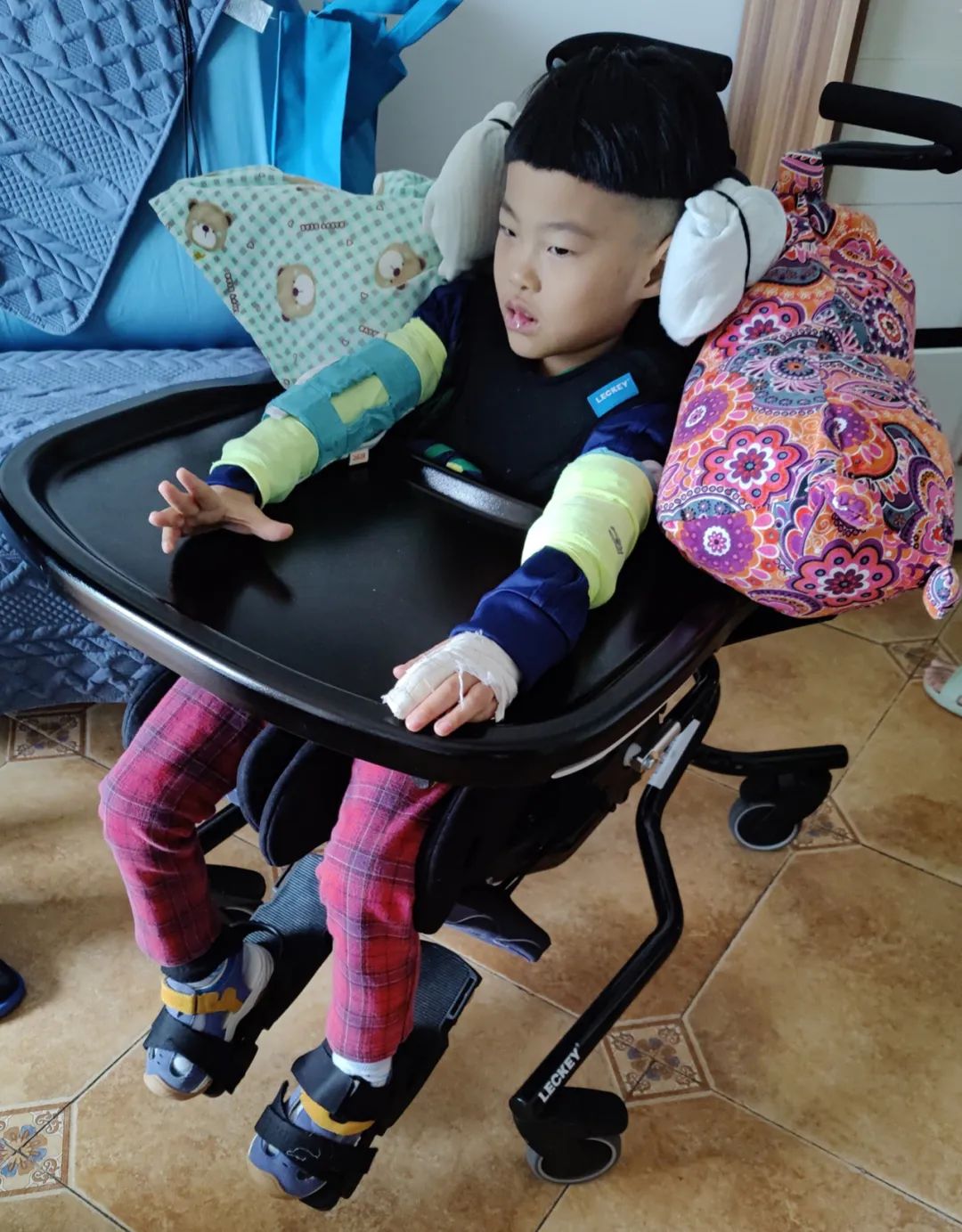 男童喜咬手指甲被诊为自毁容貌症,5岁男孩患自毁容貌症