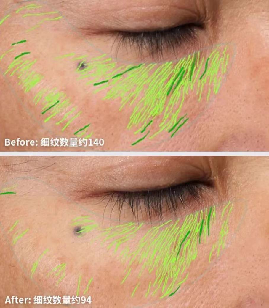 赫莲娜黑绷带面霜真的那么好用吗 (赫莲娜黑绷带面霜什么时间上市)