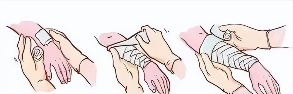 事故大出血抢救成功几率,大出血休克急救流程