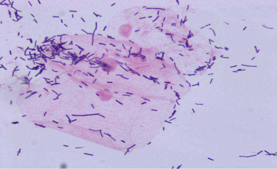 派特灵生物,派特灵生物讲解