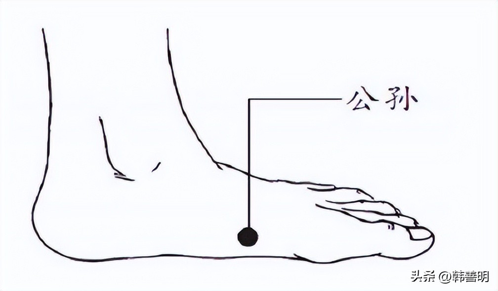 韩善明灸法医案精选（62）——妊娠恶阻案