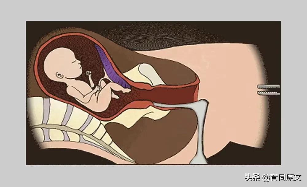 你们是怎么意外怀孕的,女人怎么会怀孕