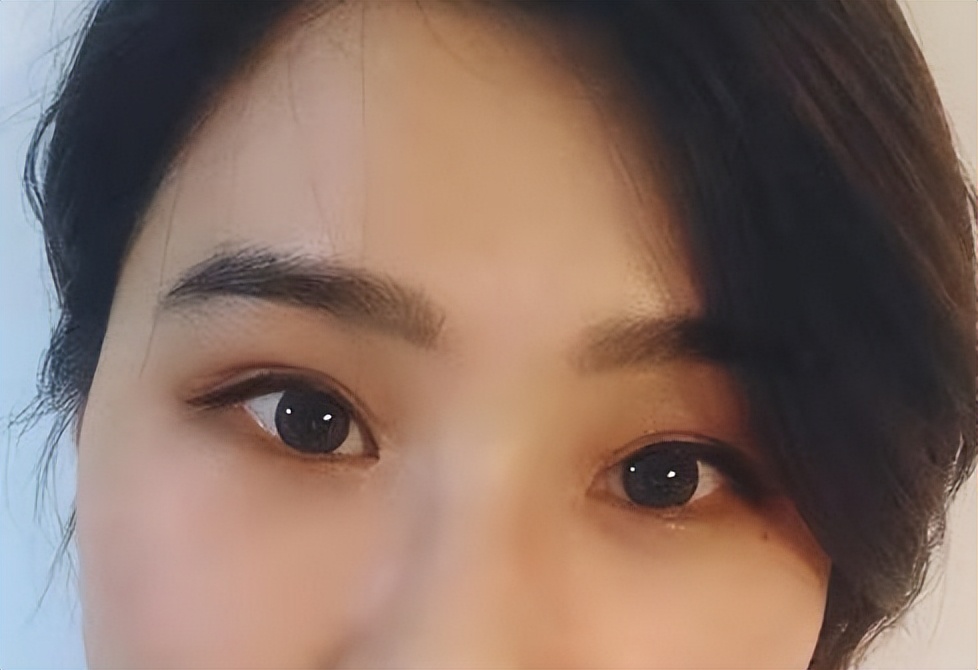 细节主义者眼中的妈生双眼皮