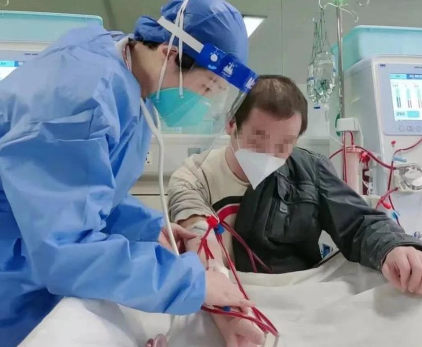 血液净化治疗新冠肺炎效果,连续性血液净化crrt操作视频