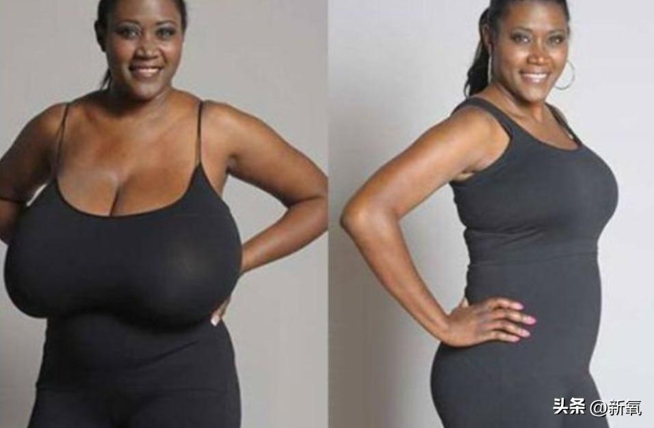 胸部明显大小不一怎么办,胸部越来越小是病理吗