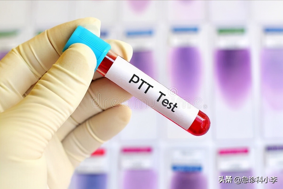 医生血脂化验单,医生一步一步教您看血脂化验单