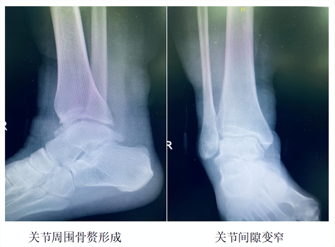 全球首列什么手术在哈医大,哈医大一院完成顶级手术
