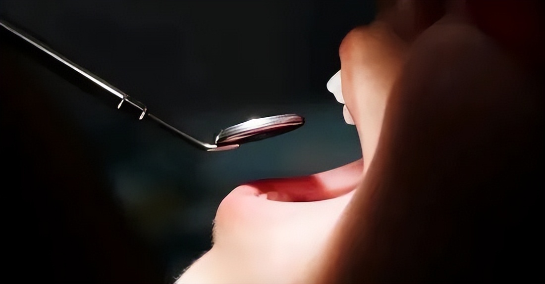 公立医院种牙集采吗,民营医院如何应对种植牙集采