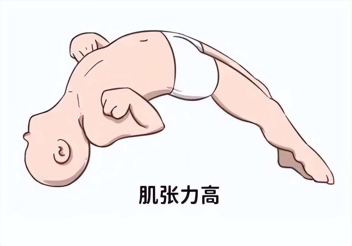 脑瘫矫形手术后康复,脑瘫康复后怎么样恢复