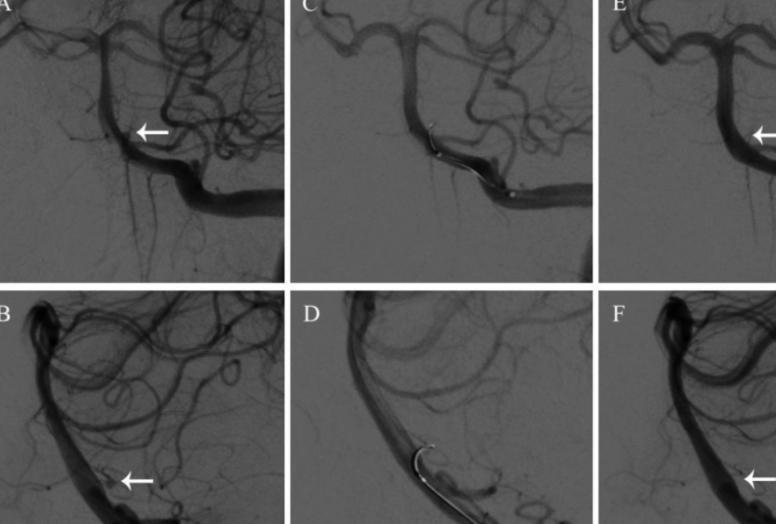 长期服用奥美拉唑要注意以下几点,奥美拉唑是毒药吗