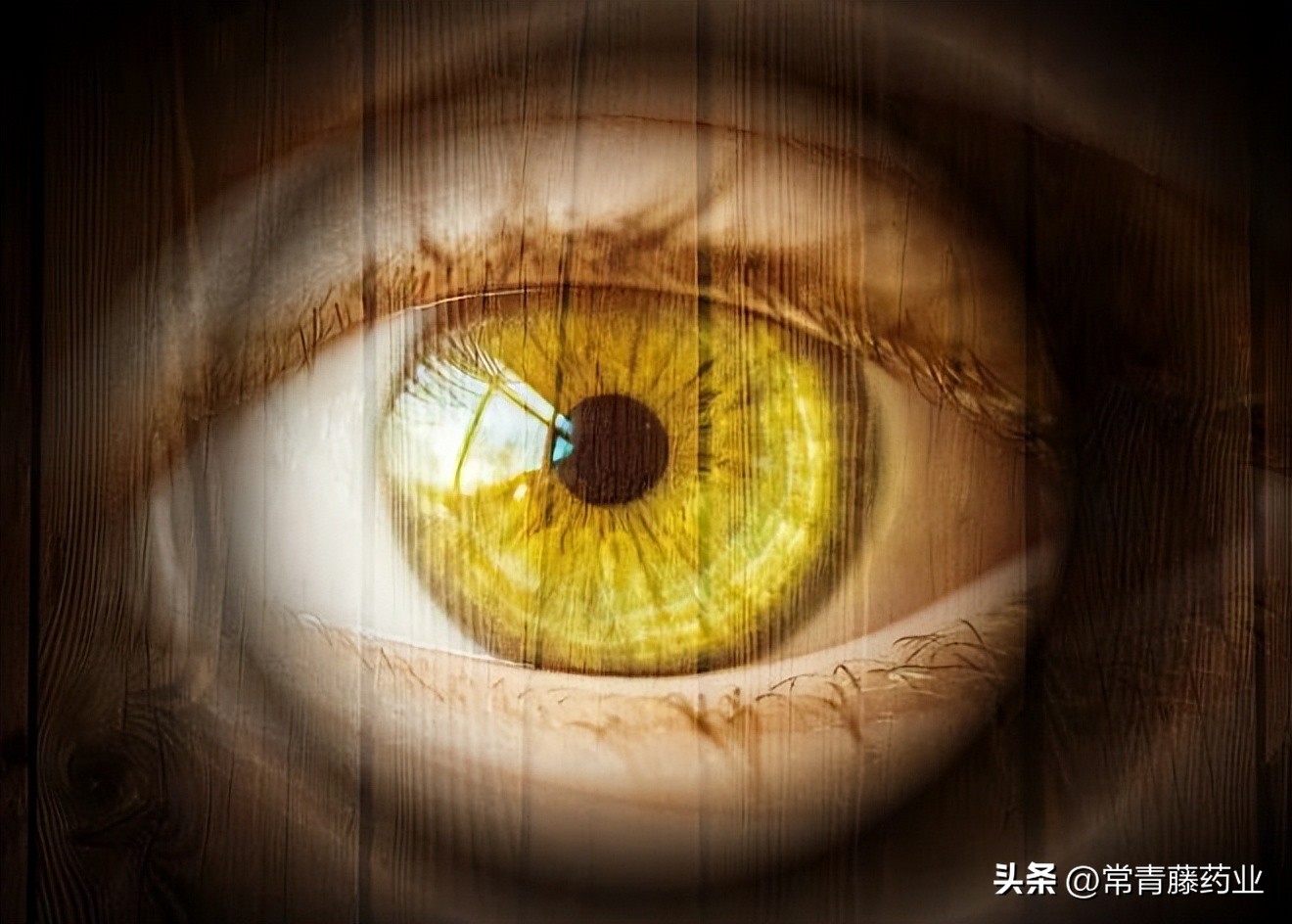 眼睛里出现一条又白又长的一条线,眼睛里出现了一个白点