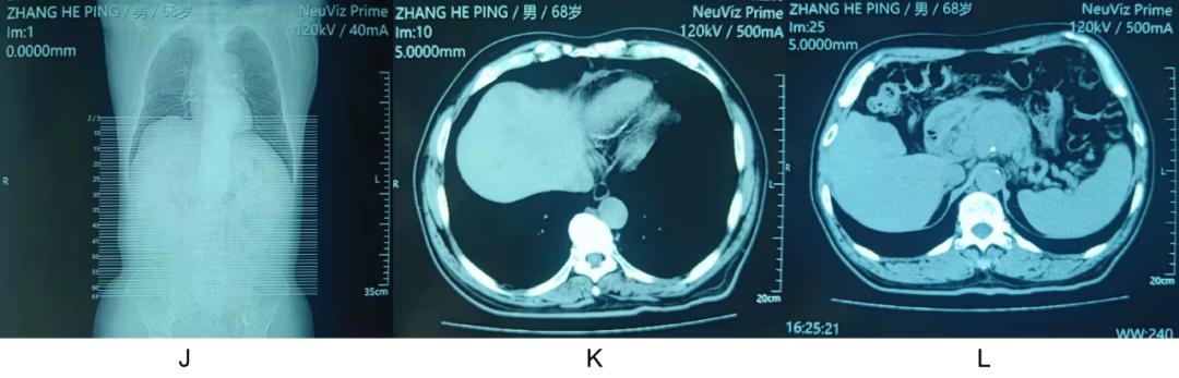 mrsa用什么药,mrsa对哪些药物敏感