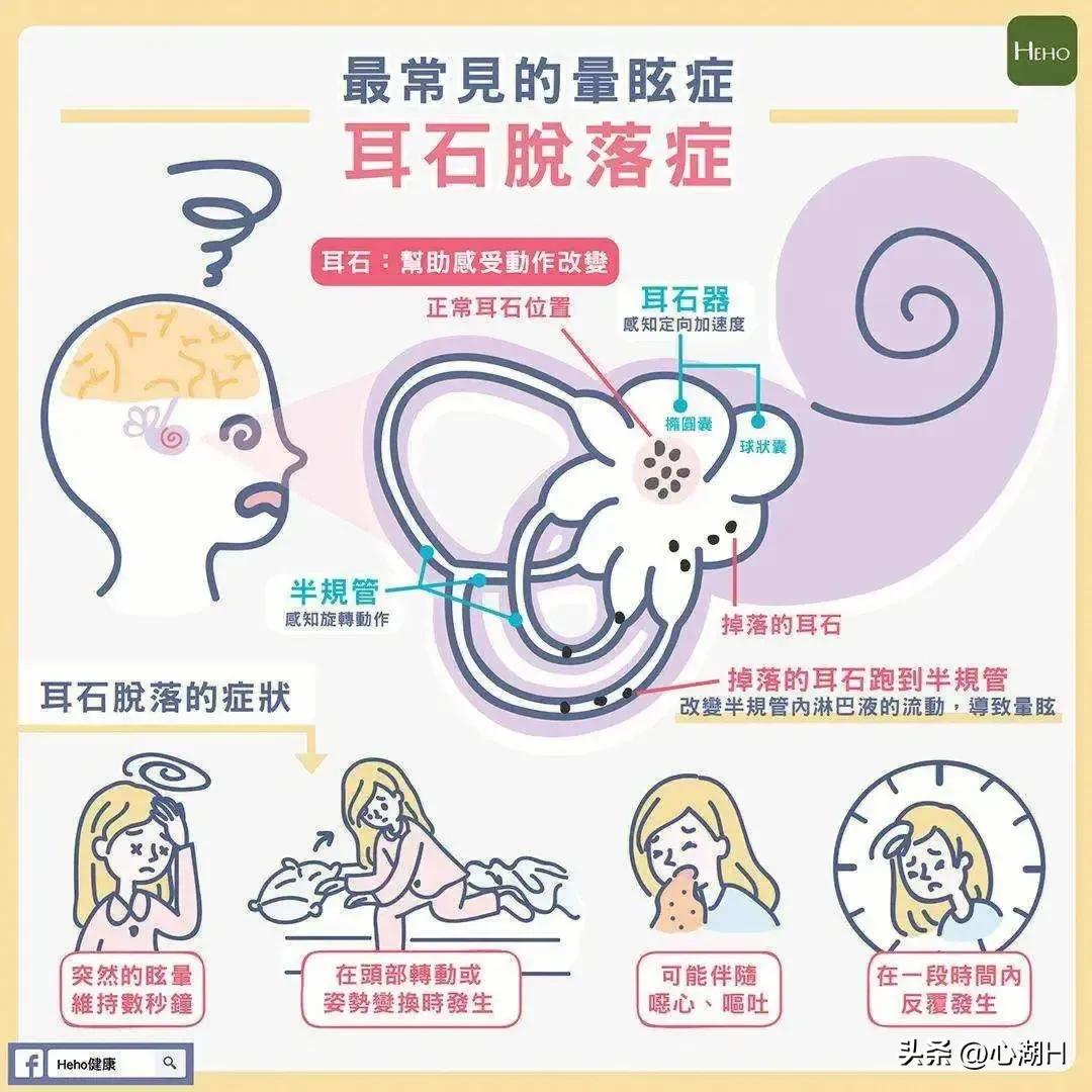 耳朵里的小石头掉了怎么办,耳朵里有小石头是怎么回事