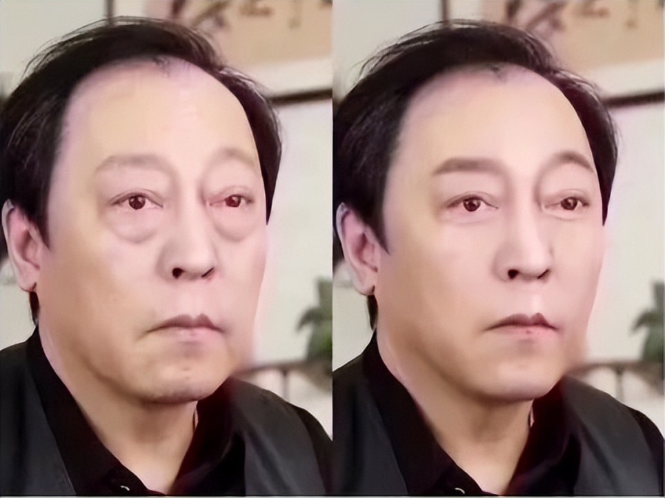 什么干货补眼强肾,拿什么来拯救我的眼袋