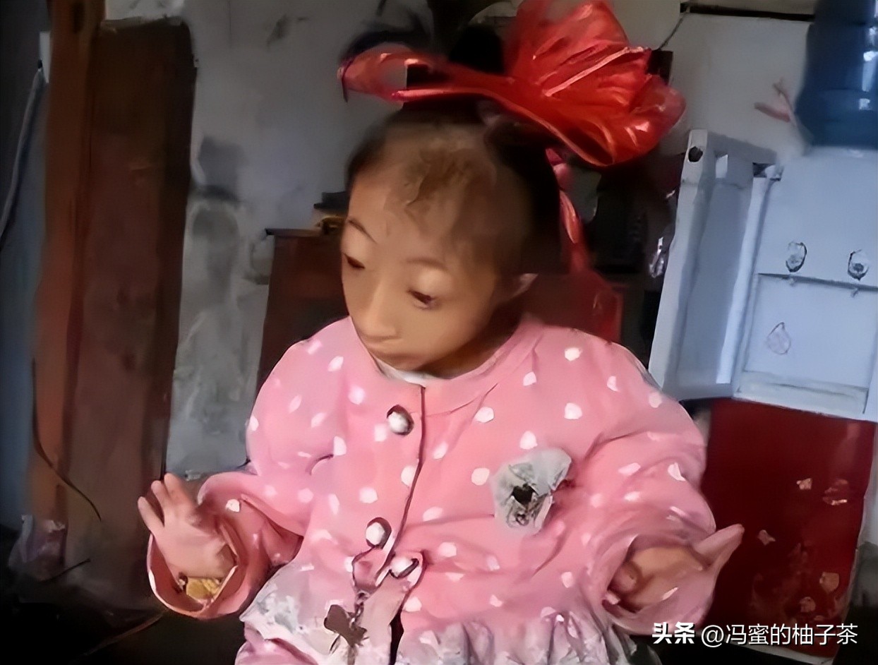 2009年湖南女子生下重2斤小猴子,湖南女子生了个小猴子上综艺节目