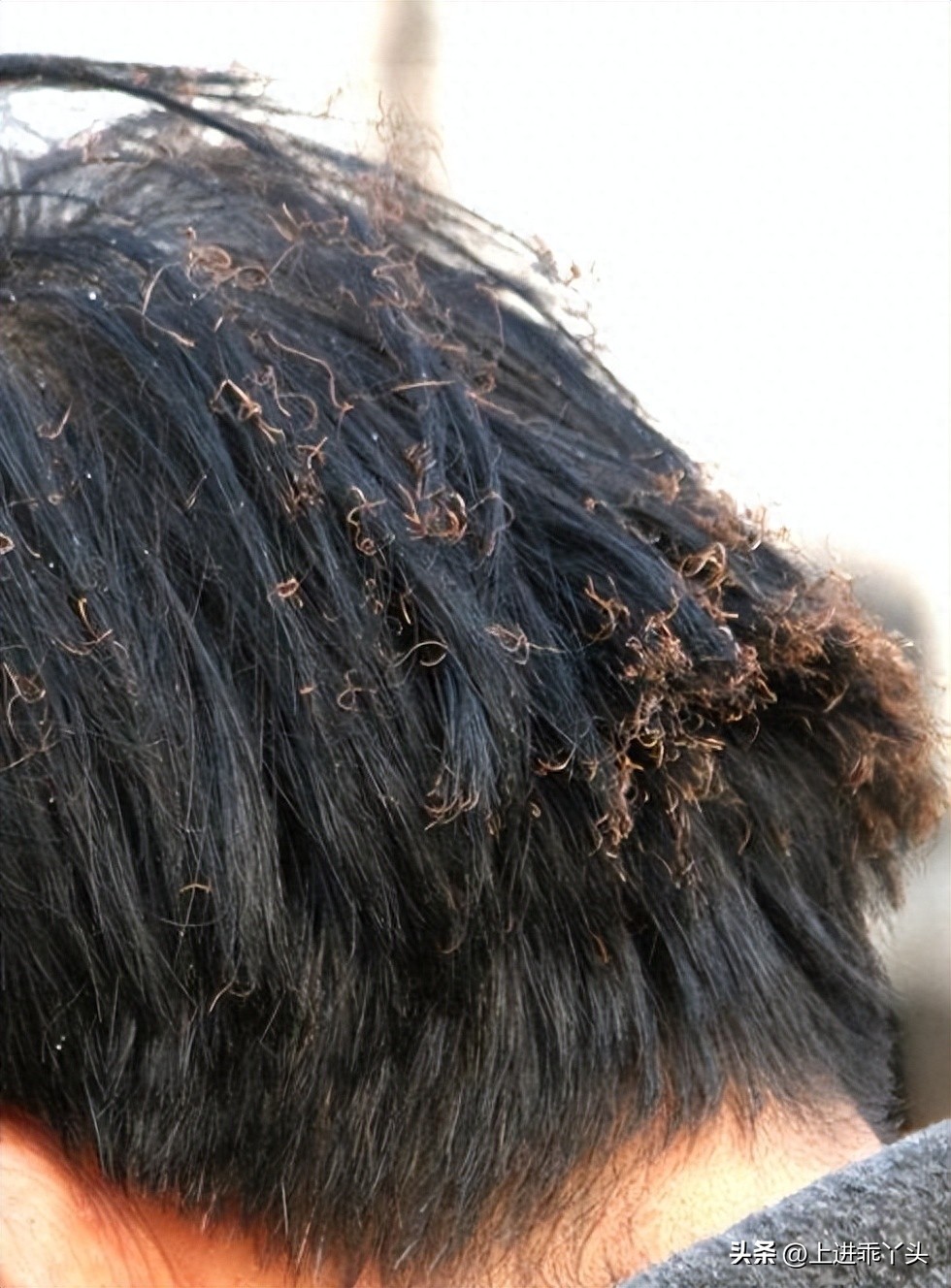 羽绒被长螨虫吗,羽绒被晾晒飞出的白色灰尘特别多