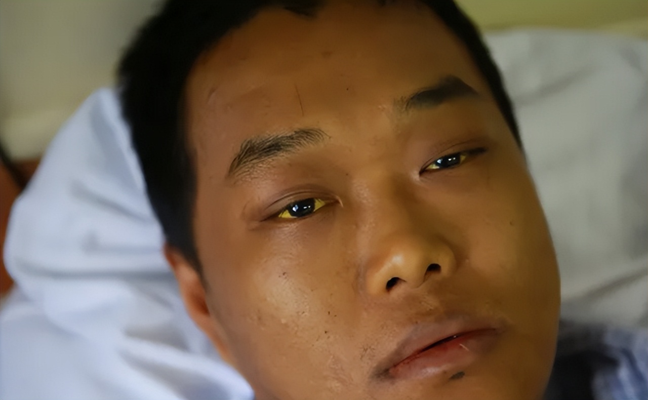 有乙肝病毒的人可以吃羊肉吗,乙肝吃羊肉的禁忌