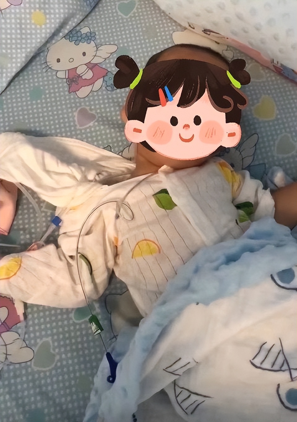 国产氯巴占片获批上市,国产氯巴占上市