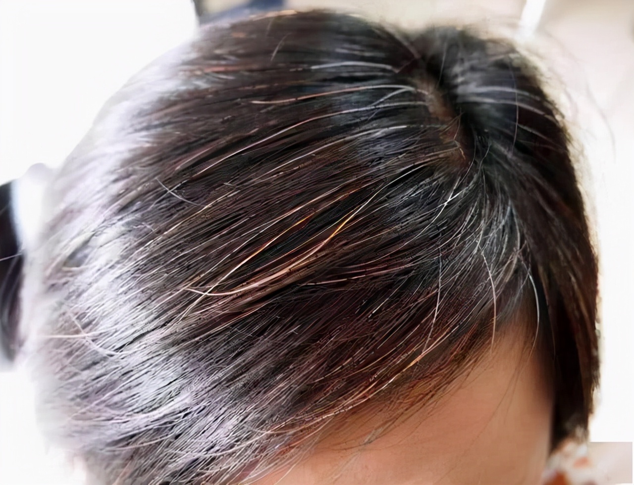 长白头发对我们的健康来说是一件好事？不妨听听哈佛研究怎么说的