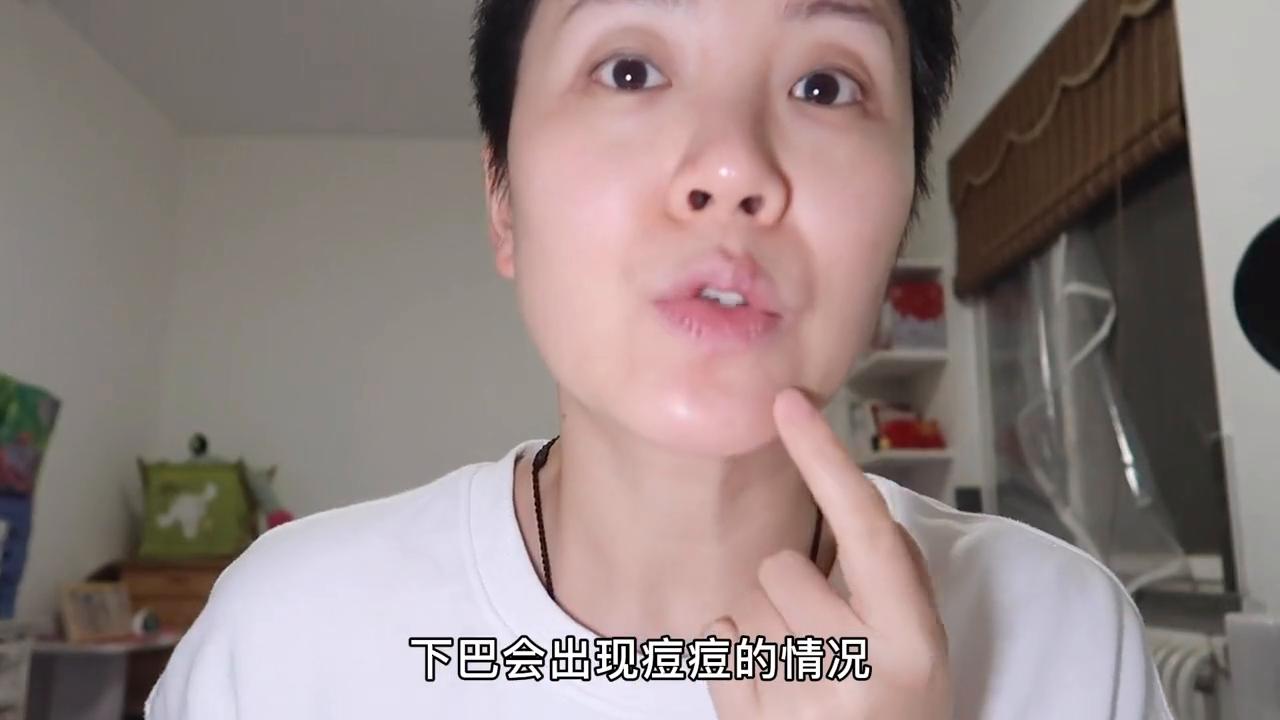 月见草吃了长痘痘什么原因,吃月见草为什么皮肤会好