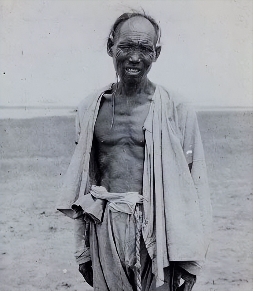 减肥后面黄肌瘦怎么办,为什么运动减肥看着瘦了体重没减