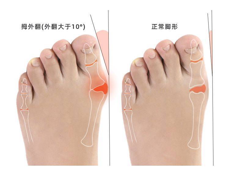 穿错鞋了怎么化解,穿错了鞋脚臭怎么办