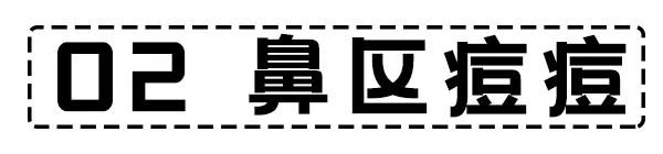 面部危险三角区反复起痘痘怎么办,脸颊周围痘痘的正确消除方法