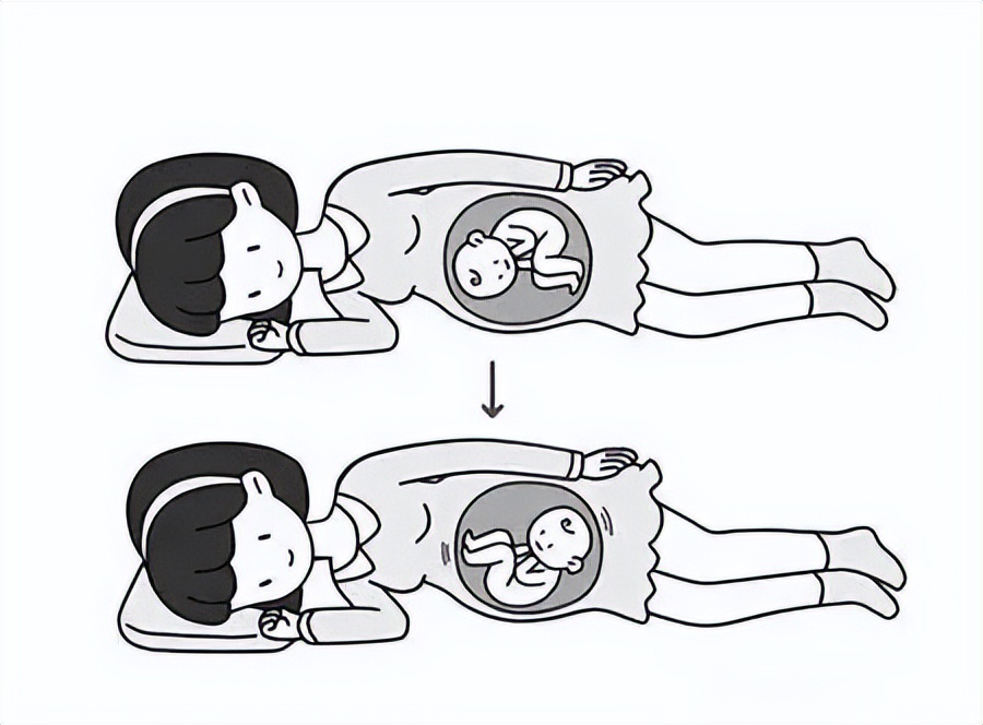 脐带绕颈胎位不正可以顺产吗,胎位不正脐带绕颈能做胸膝卧位