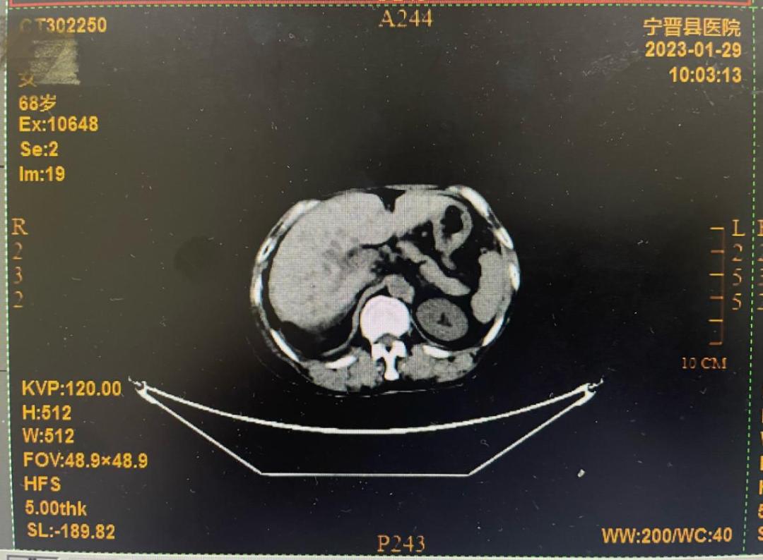 肿瘤君台词,肿瘤君电视剧
