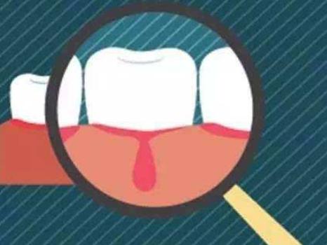 电动牙刷的优缺点在哪,电动牙刷小米t500和飞利浦hx6511