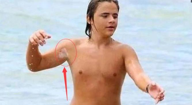 杰克逊大儿子遗传病,迈克尔杰克逊去世得了什么疾病