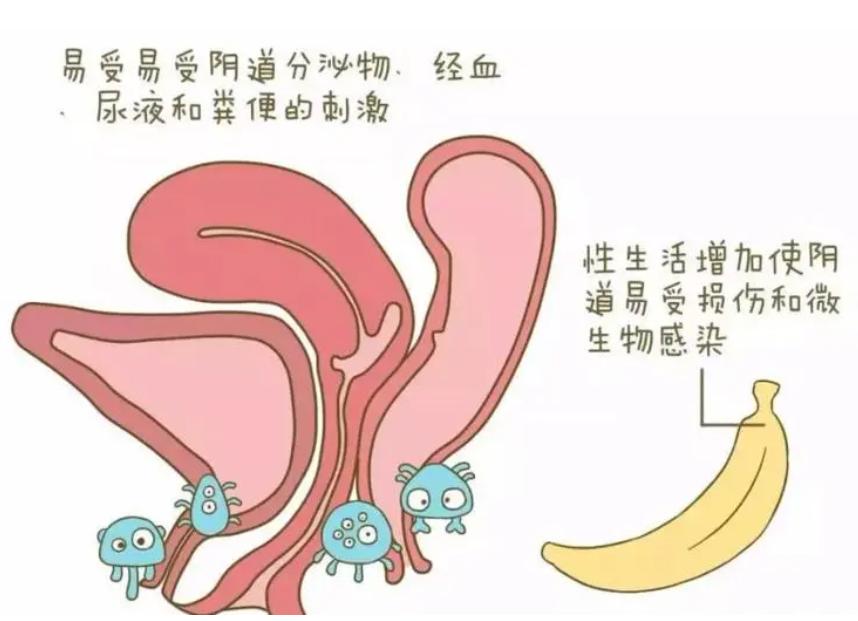 30岁的女人患上了阴道松弛，老公都不愿意碰她！怎么办？