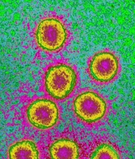 蜱虫致4位老人死亡,河南又一老人因蜱虫病死亡