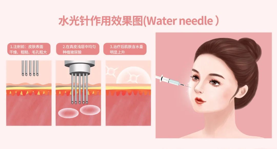 几个平时可做简单有效的医美项目,皮肤状态很好医美项目可以做哪些