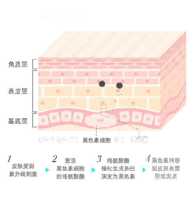微针祛斑用什么药导入,涂抹式祛斑祛痣