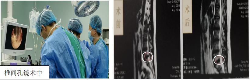 骨科必看的科普｜|得了腰椎间盘突出症，选择何种治疗方式才好？