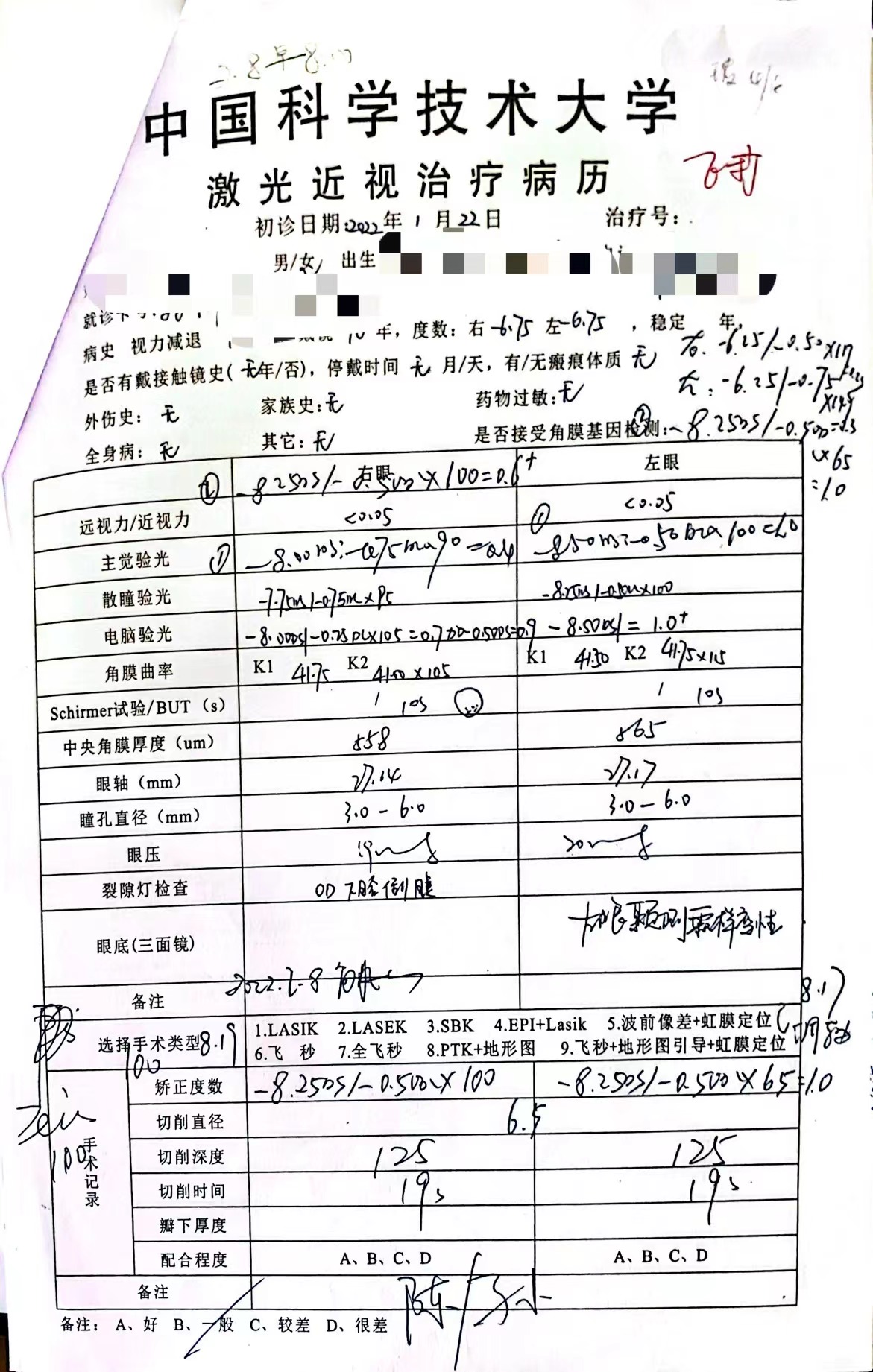 做黄斑裂孔手术是否能引起失明,女子做近视手术后又近视后续