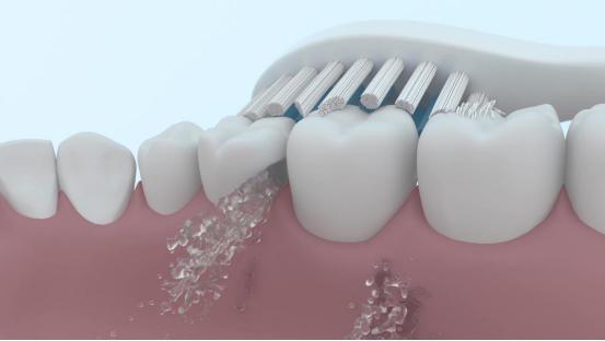 电动牙刷的危害弊端,到底是普通牙刷好还是电动牙刷好