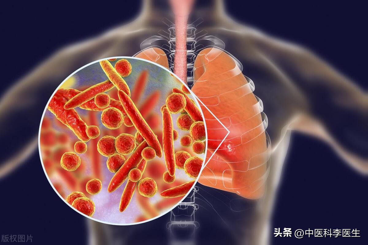 左氧氟沙星莫西沙星阿奇霉素,左氧氟沙星莫西沙星环丙沙星排序