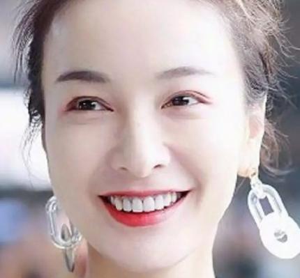 烤瓷牙的明星,烤瓷牙的明星都有谁