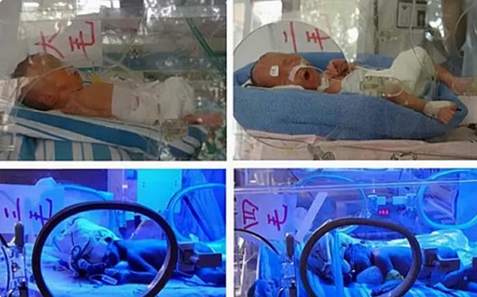 浙江31岁女子产四胞胎,湖南妇女生下八胞胎是否真实